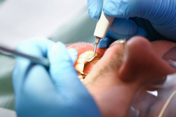 Best Emergency Dentist for Knocked-Out Tooth in Walker Valley, NY