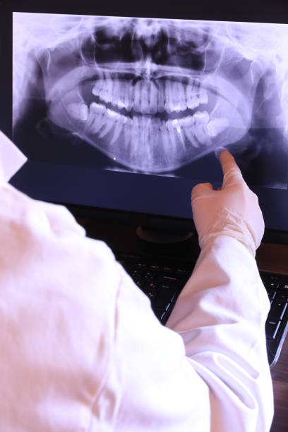 Best Broken or Cracked Tooth Emergency Dentist in Walker Valley, NY